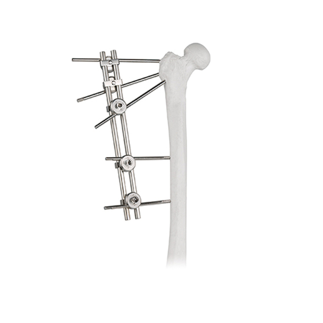 Fixateur externe à double tiges