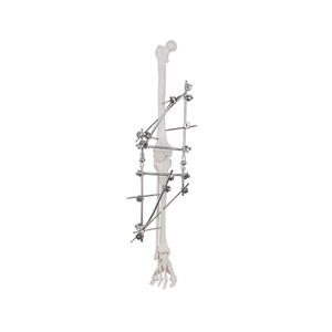 Fixateur externe du genou 9100-2701