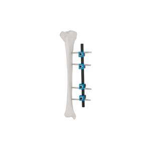 Fixateur externe de type droit 8100-14