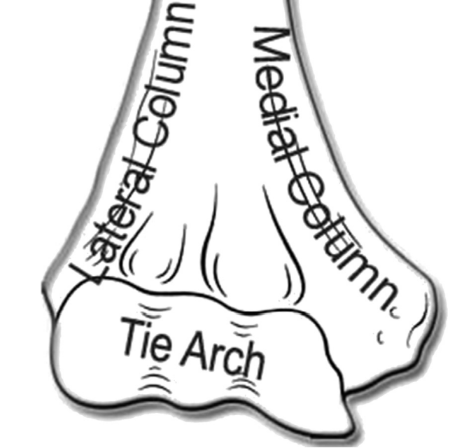 Fracture distale de l'hum&eacute;rus