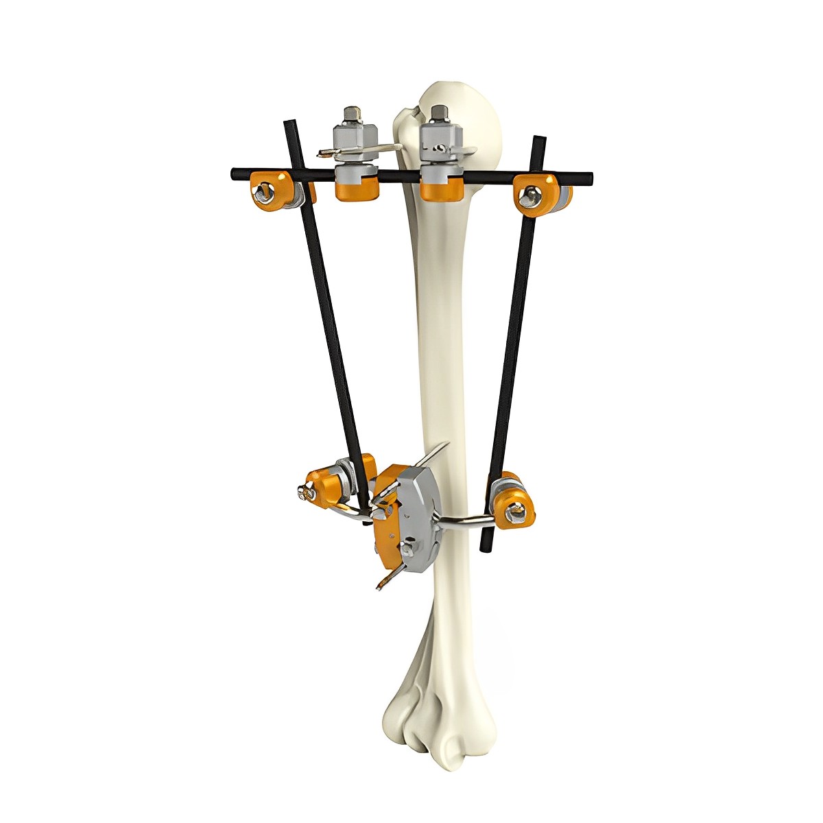 Fixateur externe pour petits fragments