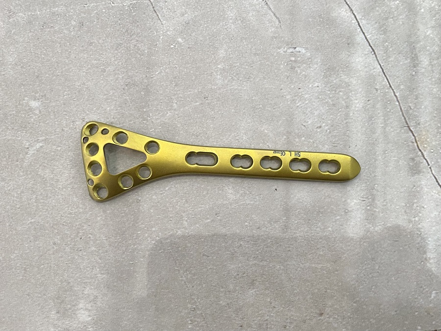 Plaque de verrouillage distale dorsale radiale delta