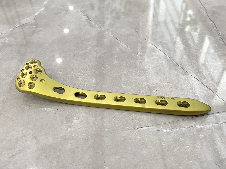 Plaque de verrouillage tibial lat&eacute;ral proximal