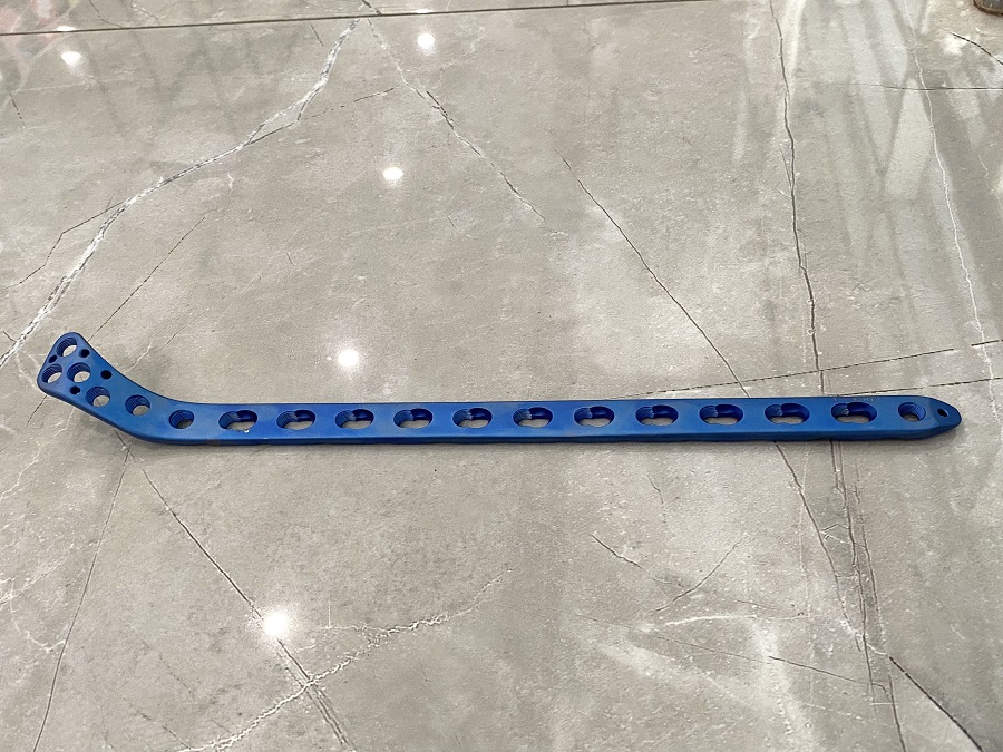 Plaque de verrouillage du contrefort de la t&ecirc;te tibiale lat&eacute;rale