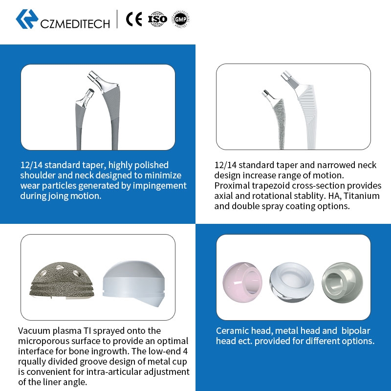 Proth&egrave;ses de hanche et de genou