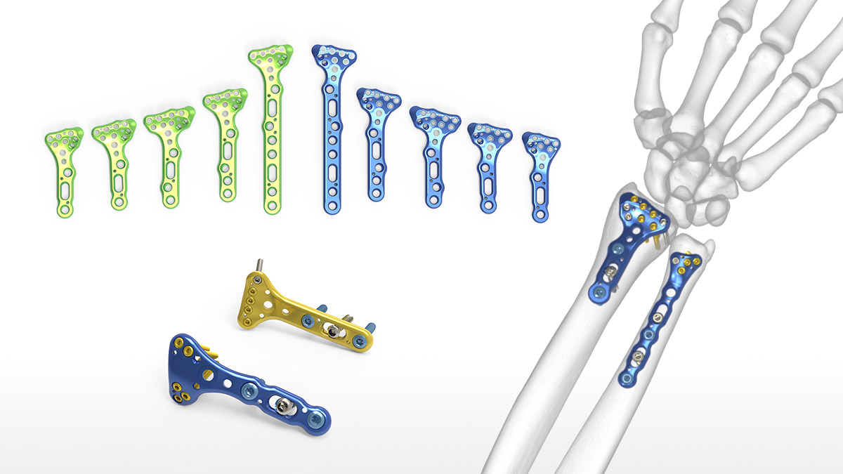 Plaque de verrouillage