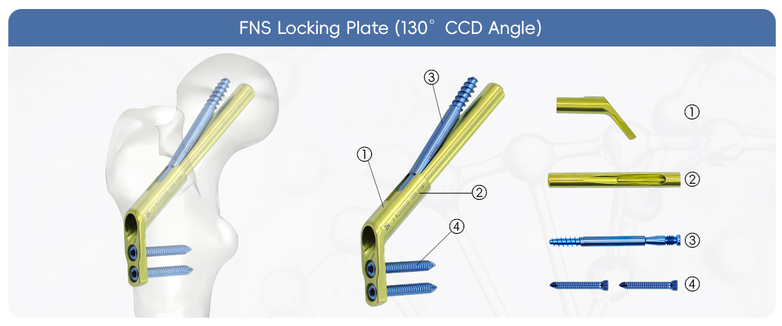 czmeditech-fns-syst&egrave;me-du-cou-f&eacute;moral-fixation-fracture-de la hanche