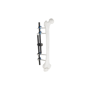 Fixateur externe de type droit 8100-10