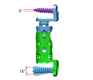 chirurgie vert&eacute;brale cage-4