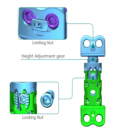chirurgie vert&eacute;brale Cage-1
