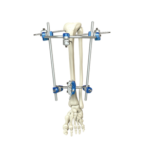 Fixateur externe du tibia proximal