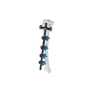 Type T Fixateur externe 8100-12
