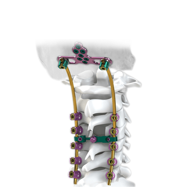 Système de vis cervicales postérieures