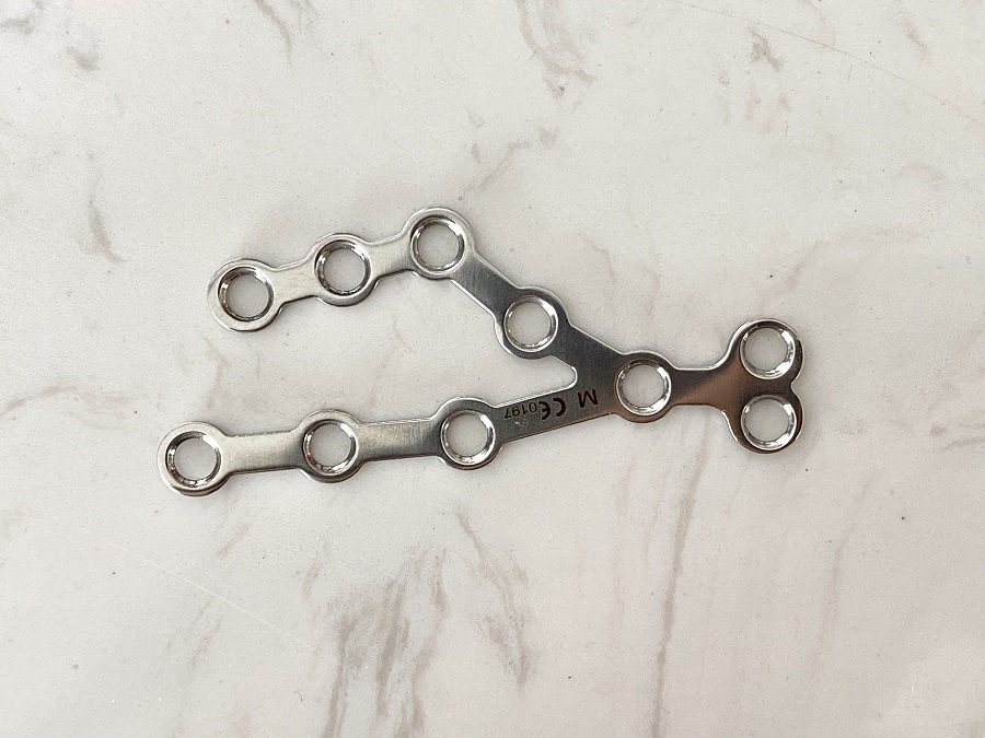 Plaque calcan&eacute;enne