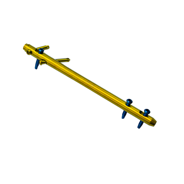 Clou de cheville de fusion de l'arrière-pied