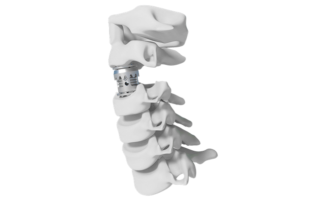 Cage lombaire extensible Stryker
